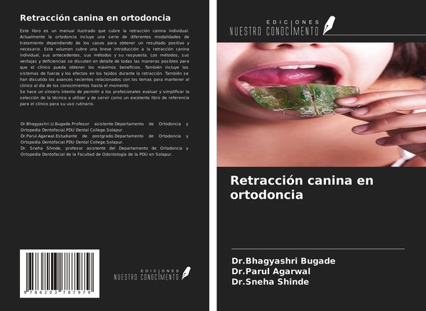 Produktbild: Retracci&oacute;n canina en ortodoncia