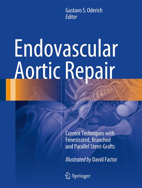 Produktbild: Endovascular Aortic Repair