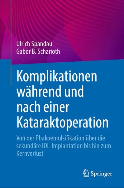 Produktbild: Komplikationen w&auml;hrend und nach einer Kataraktoperation
