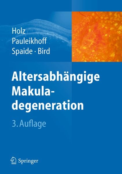 Produktbild: Altersabh&auml;ngige Makuladegeneration