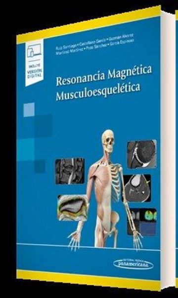 Produktbild: Resonancia Magn&eacute;tica Musculoesquel&eacute;tica