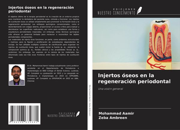 Produktbild: Injertos &oacute;seos en la regeneraci&oacute;n periodontal