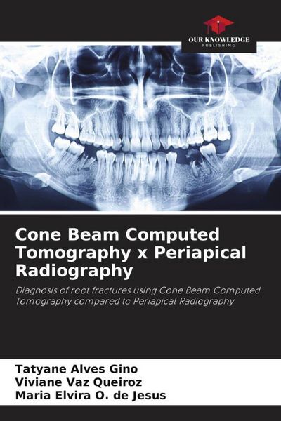 Produktbild: Cone Beam Computed Tomography x Periapical Radiography