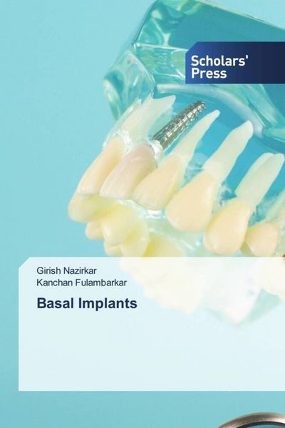Produktbild: Basal Implants