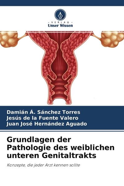 Grundlagen der Pathologie des weiblichen unteren Genitaltrakts, Taschenbuch von Damián Á. Sánchez Torres , Jesús de la Fuente Valero , Juan José