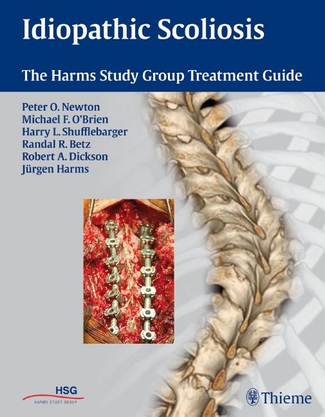 Produktbild: Idiopathic Scoliosis