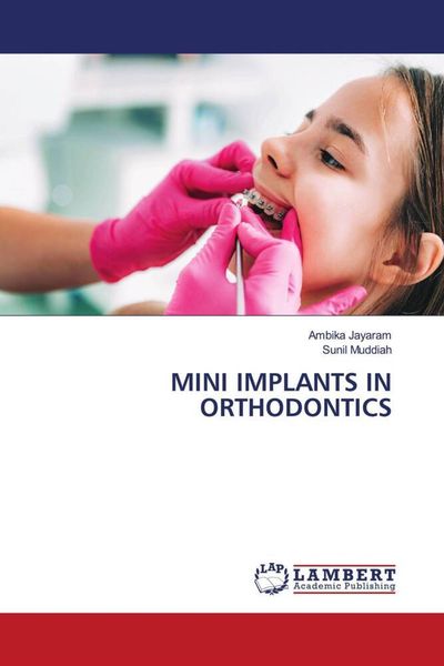 Produktbild: Mini Implants in Orthodontics
