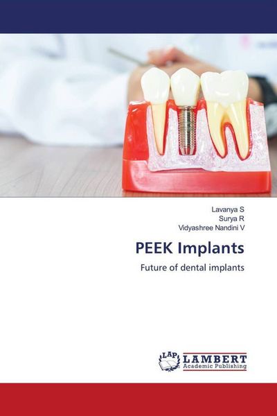 Produktbild: PEEK Implants