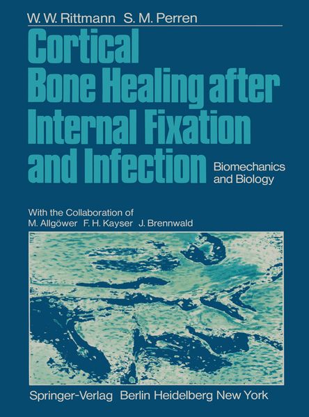 Produktbild: Cortical Bone Healing after Internal Fixation and Infection