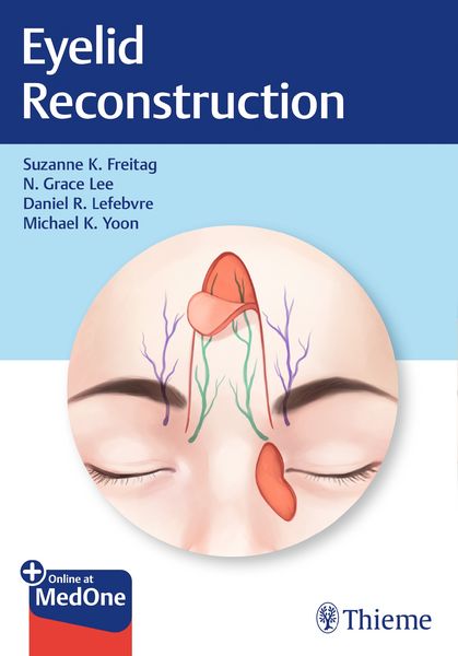 Produktbild: Eyelid Reconstruction