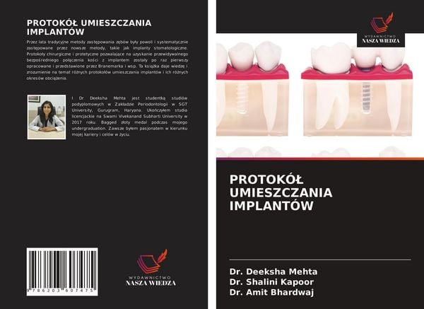 Produktbild: Protok&oacute;&iquest; Umieszczania Implant&oacute;w