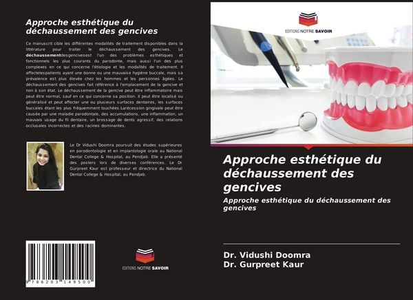 Produktbild: Approche esth&eacute;tique du d&eacute;chaussement des gencives