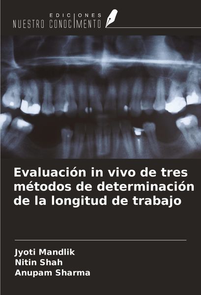 Produktbild: Evaluaci&oacute;n in vivo de tres m&eacute;todos de determinaci&oacute;n de la longitud de trabajo