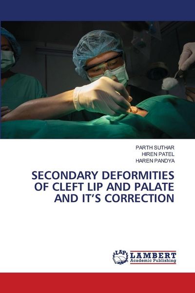 Produktbild: Secondary Deformities Of Cleft Lip and Palate and It's Correction