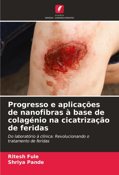 Produktbild: Progresso e aplica&ccedil;&otilde;es de nanofibras &agrave; base de colag&eacute;nio na cicatriza&ccedil;&atilde;o de feridas