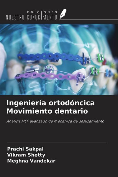 Produktbild: Ingenier&iacute;a ortod&oacute;ncica Movimiento dentario