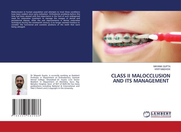 Produktbild: Class Ii Malocclusion and Its Management
