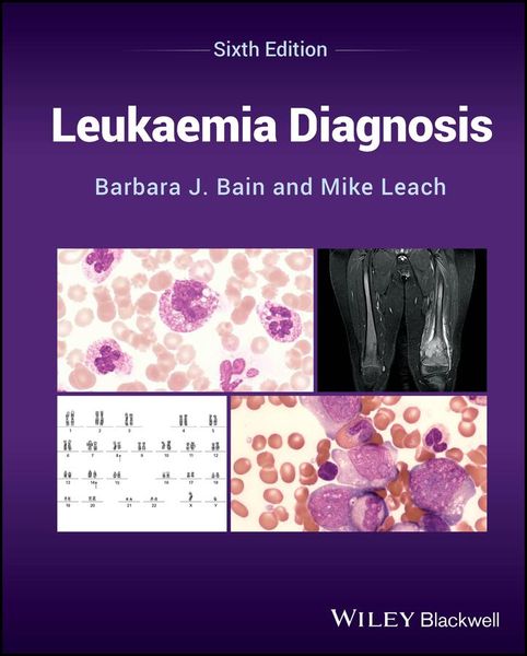Produktbild: Leukaemia Diagnosis