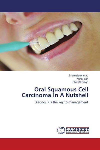 Produktbild: Oral Squamous Cell Carcinoma In A Nutshell