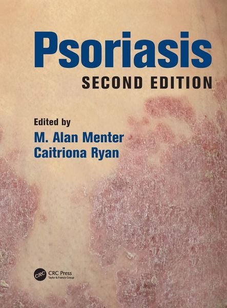 Produktbild: Psoriasis