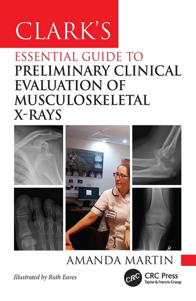 Produktbild: Clark's Essential Guide to Preliminary Clinical Evaluation of Musculoskeletal X-rays