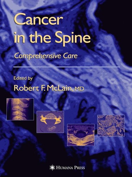 Produktbild: Cancer in the Spine