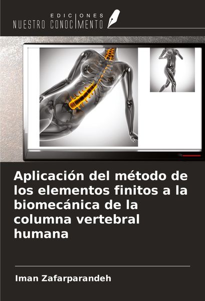Produktbild: Aplicaci&oacute;n del m&eacute;todo de los elementos finitos a la biomec&aacute;nica de la columna vertebral humana