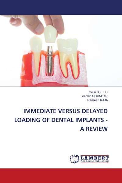 Produktbild: Immediate Versus Delayed Loading Of Dental Implants - a Review