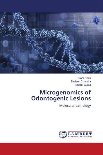 Produktbild: Microgenomics of Odontogenic Lesions
