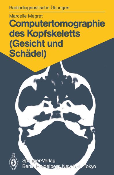 Produktbild: Computertomographie des Kopfskeletts (Gesicht und Sch&auml;del)