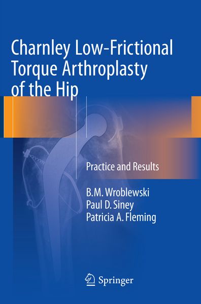 Produktbild: Charnley Low-Frictional Torque Arthroplasty of the Hip