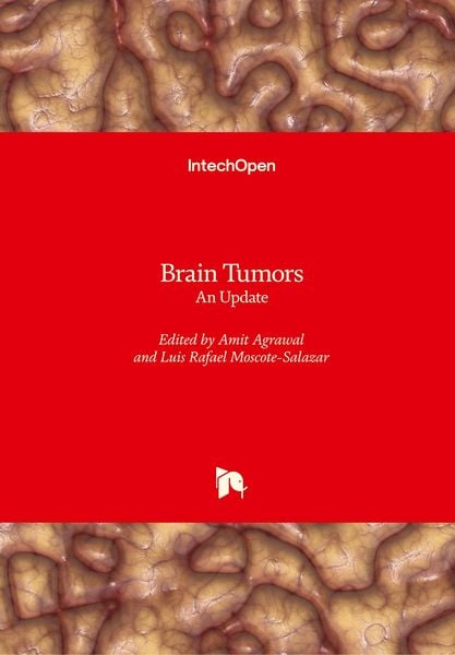 Produktbild: Brain Tumors