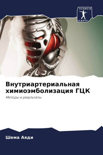 Produktbild: Vnutriarterial'naq himio&auml;mbolizaciq GCK