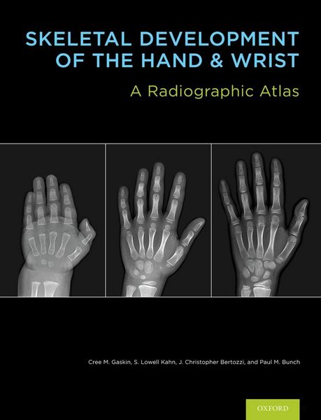 Produktbild: Skeletal Development of the Hand and Wrist