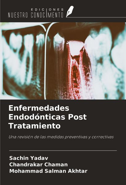Produktbild: Enfermedades Endod&oacute;nticas Post Tratamiento
