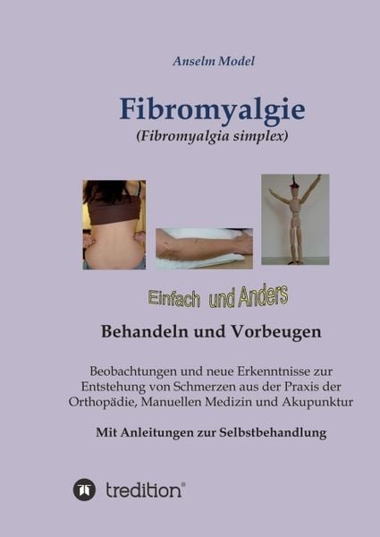 Fibromyalgie (Fibromyalgia simplex) einfach und anders behandeln und vorbeugen, Taschenbuch von Anselm Dr.Dr. Model, Tredition, 9783732368631
