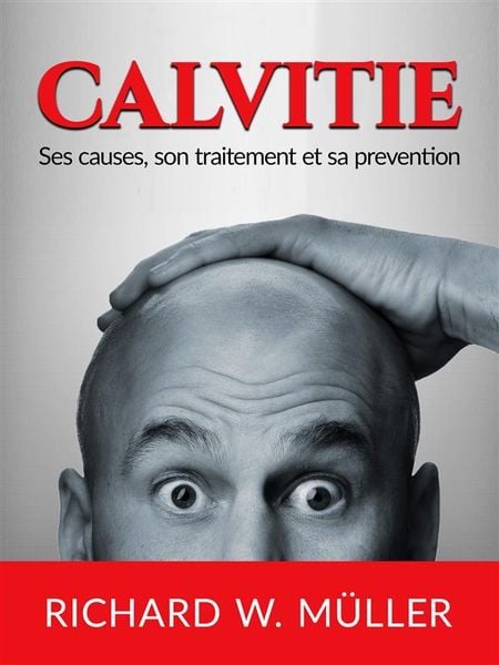 Produktbild: Calvitie (Traduit)
