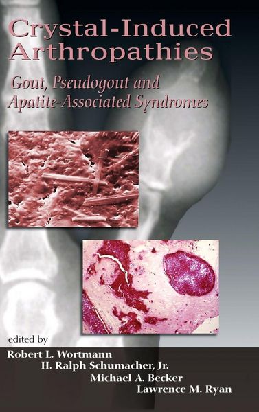 Produktbild: Crystal-Induced Arthropathies