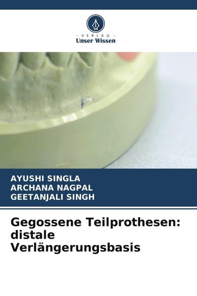 Produktbild: Gegossene Teilprothesen: distale Verl&auml;ngerungsbasis