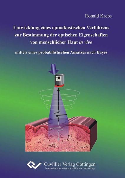 Produktbild: Entwicklung eines optoakustischen Verfahrens zur Bestimmung der optischen Eigens