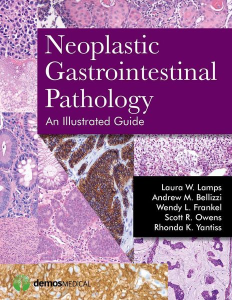 Produktbild: Neoplastic Gastrointestinal Pa