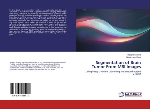 Produktbild: Segmentation of Brain Tumor From MRI Images