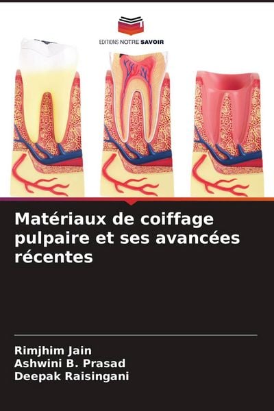 Produktbild: Mat&eacute;riaux de coiffage pulpaire et ses avanc&eacute;es r&eacute;centes