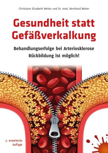 Produktbild: Gesundheit statt Gef&auml;&szlig;verkalkung