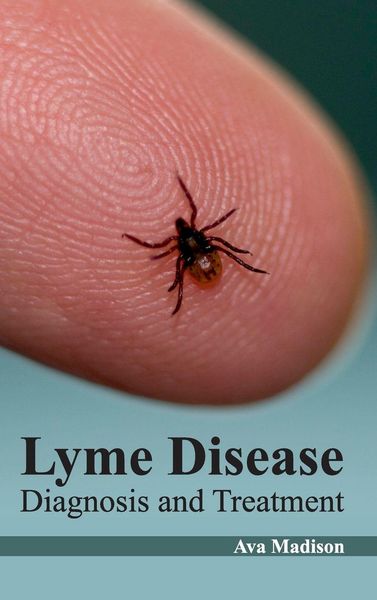 Produktbild: Lyme Disease