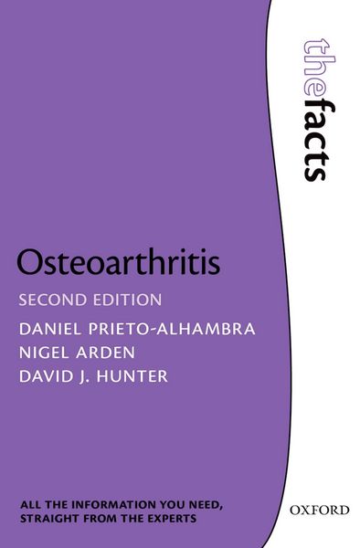 Produktbild: Osteoarthritis: The Facts