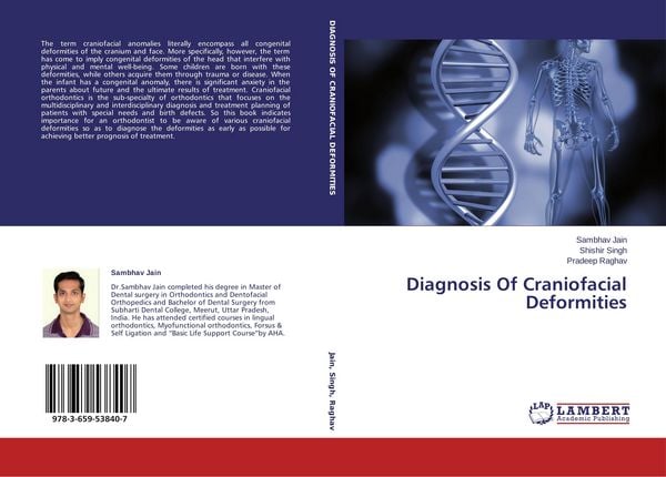 Produktbild: Diagnosis Of Craniofacial Deformities