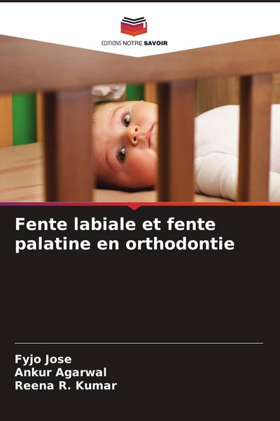 Produktbild: Fente labiale et fente palatine en orthodontie