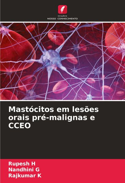 Produktbild: Mast&oacute;citos em les&otilde;es orais pr&eacute;-malignas e CCEO