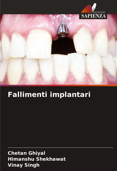 Produktbild: Fallimenti implantari